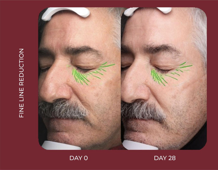 LIGHT FACIAL MOISTURISER