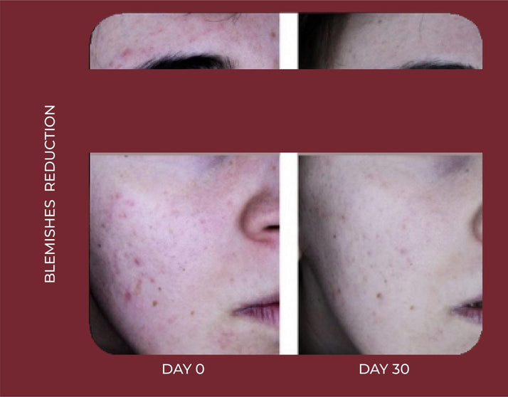 LIGHT FACIAL MOISTURISER