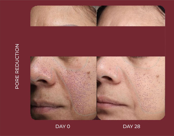 LIGHT FACIAL MOISTURISER